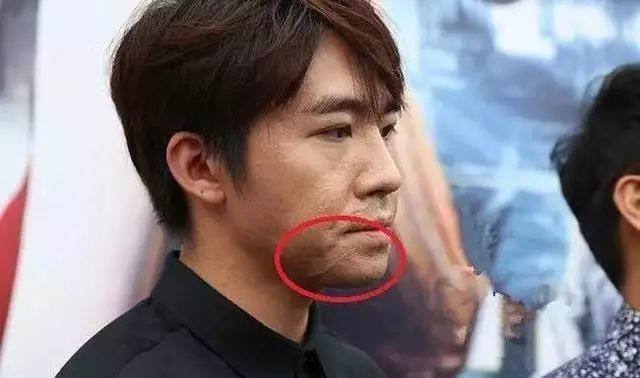 臉上有疤痕的明星，堅韌魅力的獨特印記