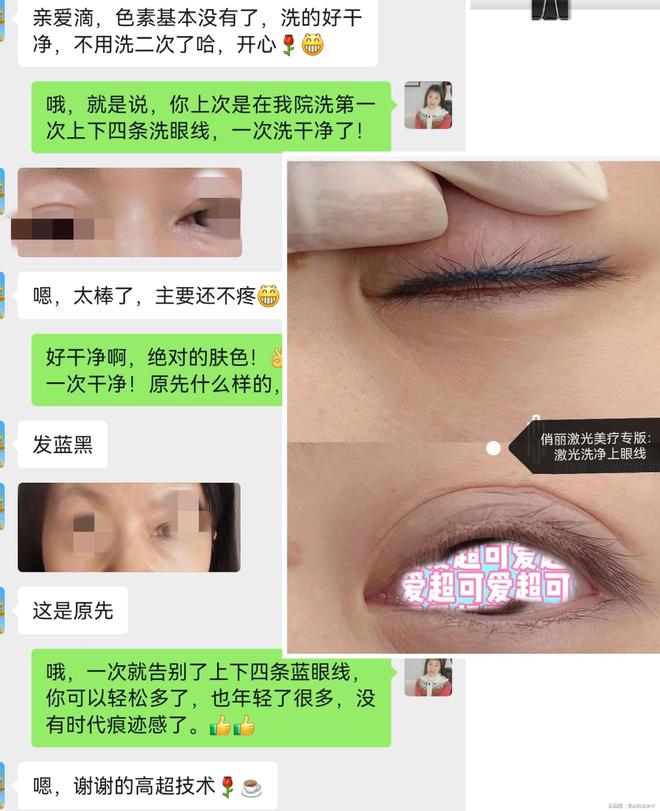 最新無痛洗眉技術，重塑美麗新顏，輕松擺脫舊眉困擾